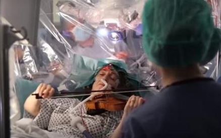 为保音乐才华 英国女子边动脑部手术边拉小提琴